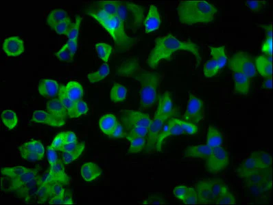 Immunocytochemistry/ Immunofluorescence - Anti-Lrp2 / Megalin antibody (AB236244)