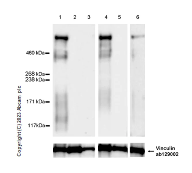 Western blot - Anti-Lrp2 / Megalin antibody [EPR26093-68] (AB313741)