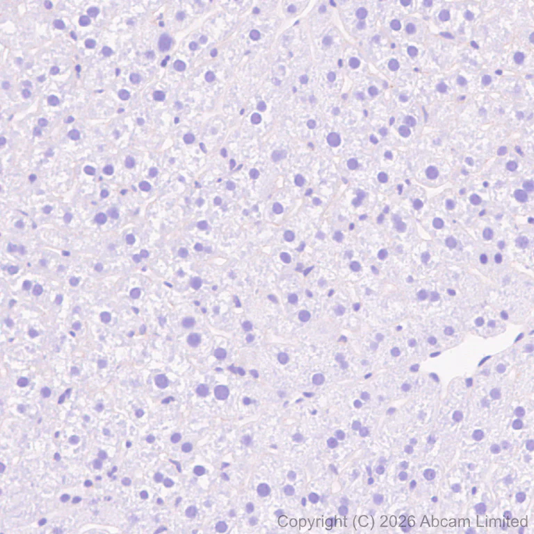 Immunohistochemistry (Formalin/PFA-fixed paraffin-embedded sections) - Anti-Lrp2 / Megalin antibody [EPR30413-507] (AB324981)