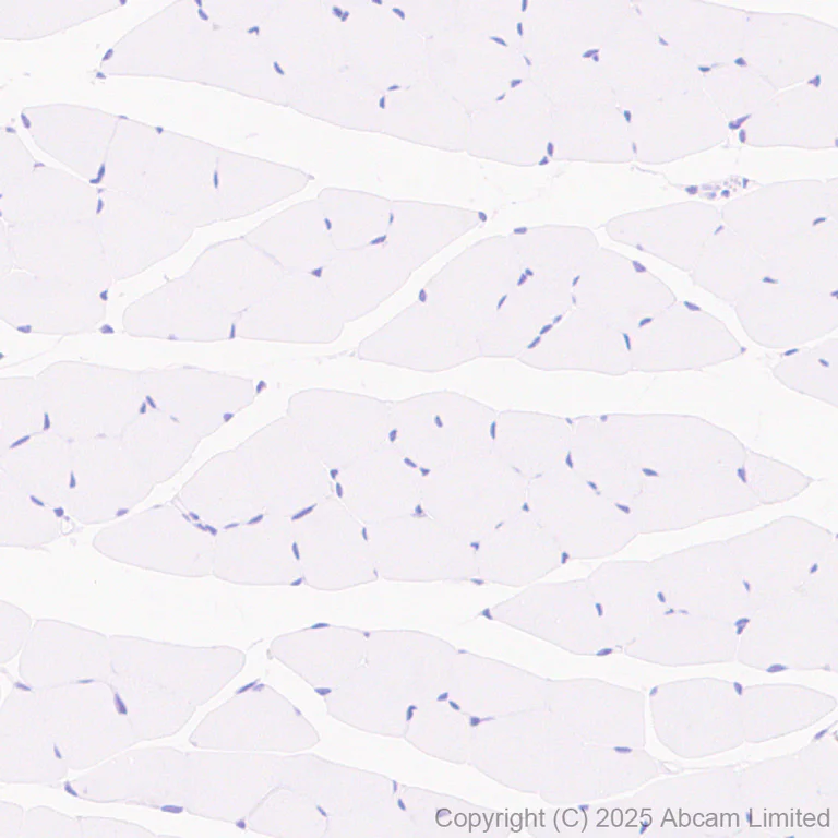 Immunohistochemistry (Formalin/PFA-fixed paraffin-embedded sections) - Anti-Lrp2 / Megalin antibody [EPR30413-507] (AB324981)