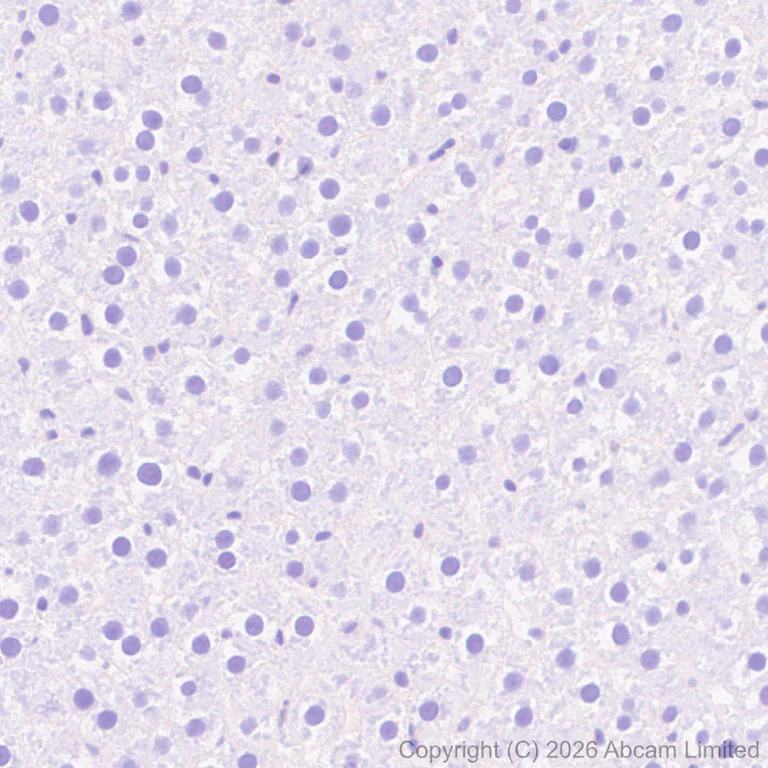 Immunohistochemistry (Formalin/PFA-fixed paraffin-embedded sections) - Anti-Lrp2 / Megalin antibody [EPR30413-507] (AB324981)