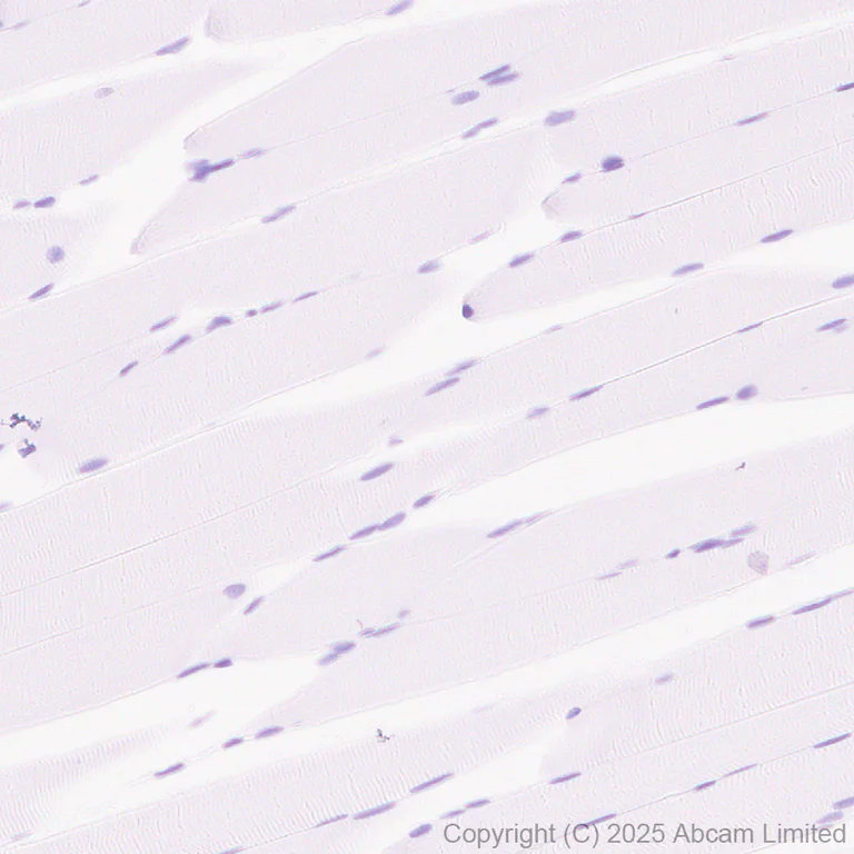 Immunohistochemistry (Formalin/PFA-fixed paraffin-embedded sections) - Anti-Lrp2 / Megalin antibody [EPR30413-507] (AB324981)