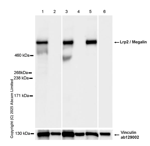 Western blot - Anti-Lrp2 / Megalin antibody [EPR30413-507] (AB324981)