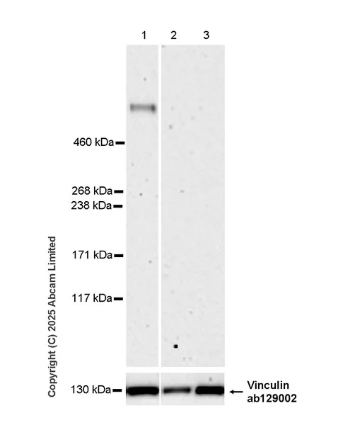 Western blot - Anti-Lrp2 / Megalin antibody [EPR30413-507] (AB324981)