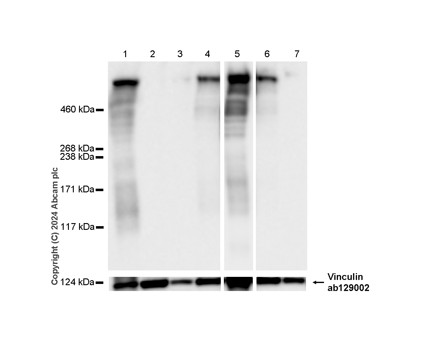 Western blot - Anti-Lrp2 / Megalin antibody [RM1150] - BSA and Azide free (AB317334), expandable thumbnail