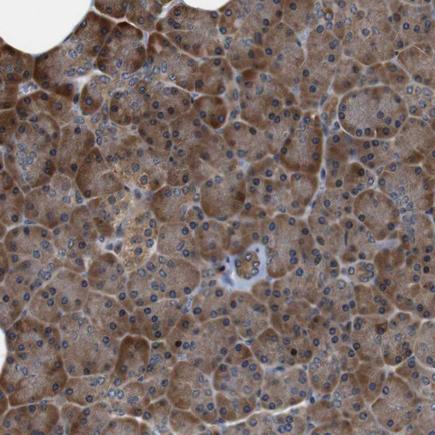 Immunohistochemistry (Formalin/PFA-fixed paraffin-embedded sections) - Anti-LRP4 antibody (AB224253)