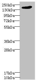 Western blot - Anti-LRP4 antibody (AB230188), expandable thumbnail