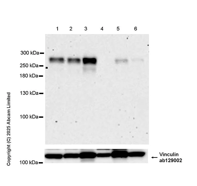 Western blot - Anti-LRP4 antibody [EPR30692-584] (AB324976)