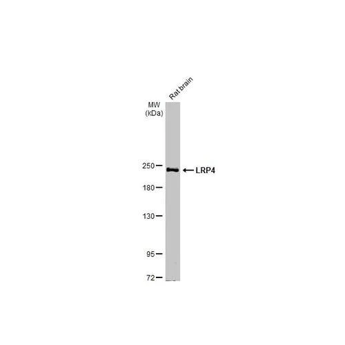 Western blot - Anti-LRP4 antibody [HL2080] (AB317131)