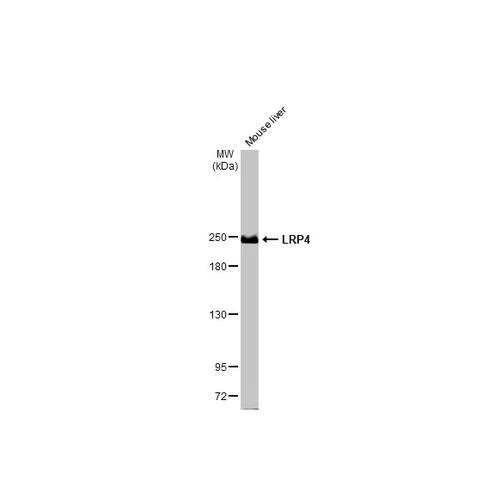 Western blot - Anti-LRP4 antibody [HL2080] (AB317131)