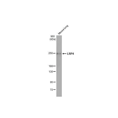 Western blot - Anti-LRP4 antibody [HL2080] (AB317131)