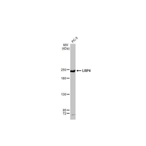 Western blot - Anti-LRP4 antibody [HL2080] (AB317131)