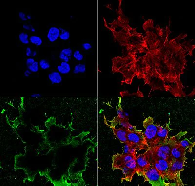 Immunocytochemistry/ Immunofluorescence - Anti-LRP4 antibody [N207/27] - N-terminal (AB174637)
