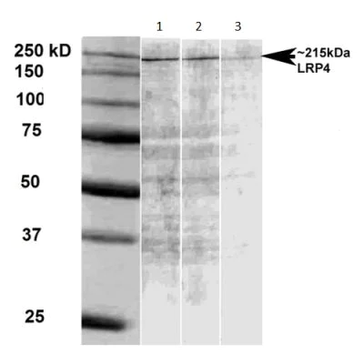 Western blot - Anti-LRP4 antibody [N207/27] - N-terminal (AB174637)