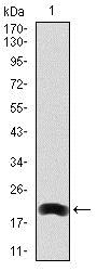 Western blot - Anti-LRP5 antibody [2B11] (AB129357), expandable thumbnail