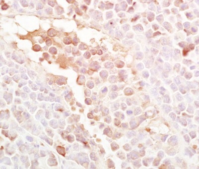 Immunohistochemistry (Formalin/PFA-fixed paraffin-embedded sections) - Anti-LRP5 antibody (AB203201)