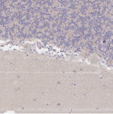Immunohistochemistry (Formalin/PFA-fixed paraffin-embedded sections) - Anti-LRP5 antibody (AB204901)
