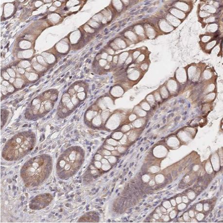 Immunohistochemistry (Formalin/PFA-fixed paraffin-embedded sections) - Anti-LRP5 antibody (AB204901)