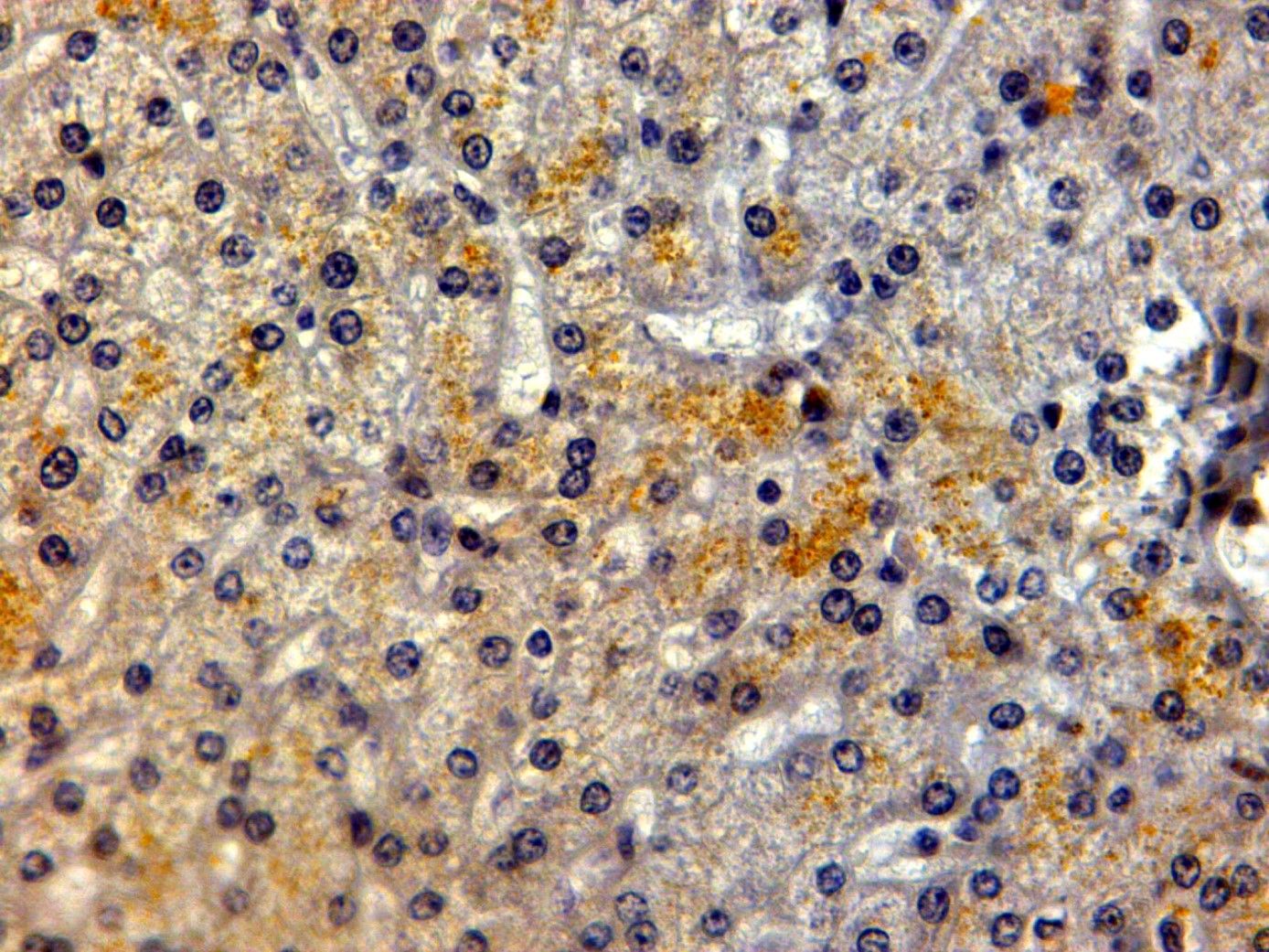 Immunohistochemistry (Formalin/PFA-fixed paraffin-embedded sections) - Anti-LRP5 antibody (AB36121)