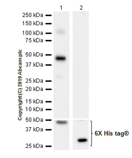 Western blot - Anti-LRP5 antibody [EPR22477-218] (AB223203)