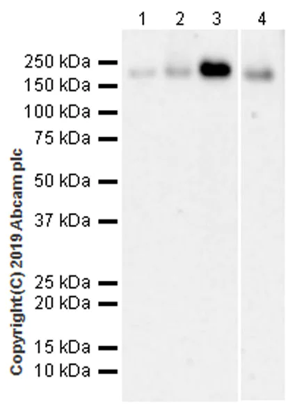 Western blot - Anti-LRP5 antibody [EPR22477-218] (AB223203)