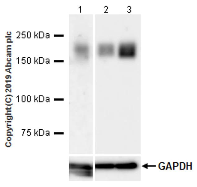Western blot - Anti-LRP5 antibody [EPR22477-218] (AB223203)