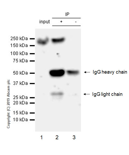 Immunoprecipitation - Anti-LRP5 antibody [EPR22477-218] - BSA and Azide free (AB256528), expandable thumbnail