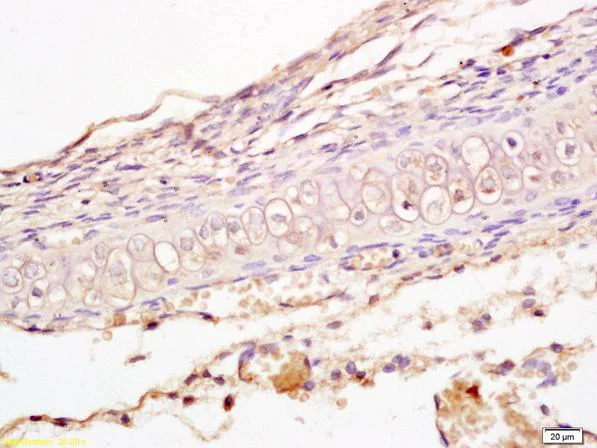 Immunohistochemistry (Formalin/PFA-fixed paraffin-embedded sections) - Anti-LRP5 + LRP6 antibody (AB217700)