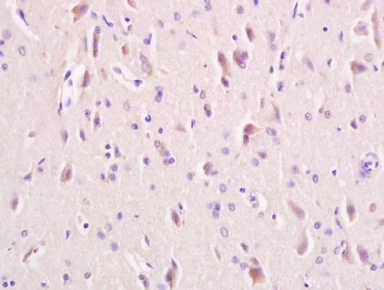 Immunohistochemistry (Formalin/PFA-fixed paraffin-embedded sections) - Anti-LRP5 + LRP6 antibody (AB217700)