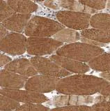 Immunohistochemistry (Formalin/PFA-fixed paraffin-embedded sections) - Anti-LRP5L antibody (AB122013)