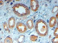 Immunohistochemistry (Formalin/PFA-fixed paraffin-embedded sections) - Anti-LRP6 antibody (AB24386)