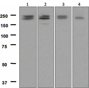 Western blot - Anti-LRP6 antibody [EPR2423(2)] (AB134146), expandable thumbnail