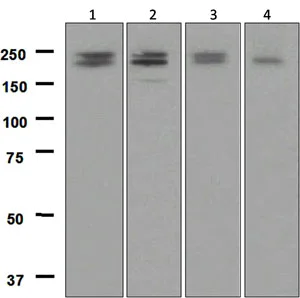 Western blot - Anti-LRP6 antibody [EPR2423(2)] (AB134146)