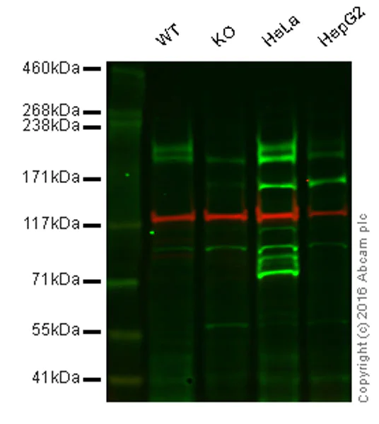 Western blot - Anti-LRP6 antibody [EPR2423(2)] (AB134146)
