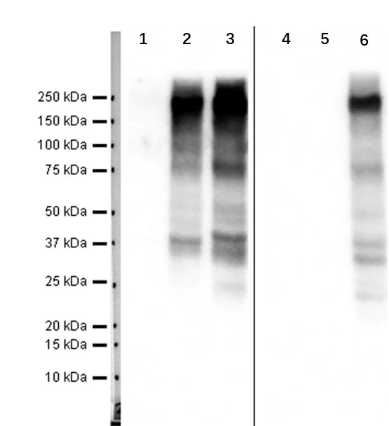 Western blot - Anti-LRP6 (phospho S1490) + LRP5 (phospho S1503) antibody [EP2360Y] - BSA and Azide free (AB247469)