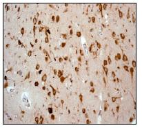 Immunohistochemistry (Formalin/PFA-fixed paraffin-embedded sections) - Anti-LRPAP1 antibody [EPR3327] (ab76500), expandable thumbnail