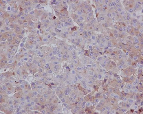 Immunohistochemistry (Formalin/PFA-fixed paraffin-embedded sections) - Anti-LRPAP1 antibody [EPR3327] (AB76500)