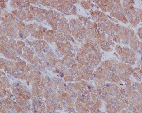 Immunohistochemistry (Formalin/PFA-fixed paraffin-embedded sections) - Anti-LRPAP1 antibody [EPR3327] (AB76500), expandable thumbnail