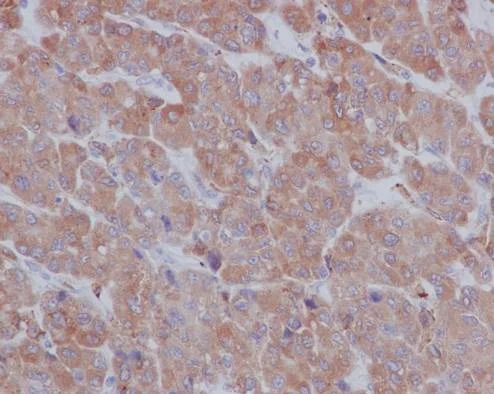 Immunohistochemistry (Formalin/PFA-fixed paraffin-embedded sections) - Anti-LRPAP1 antibody [EPR3327] (AB76500)
