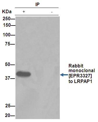 Immunoprecipitation - Anti-LRPAP1 antibody [EPR3327] (AB76500), expandable thumbnail