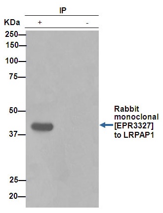 Immunoprecipitation - Anti-LRPAP1 antibody [EPR3327] (ab76500), expandable thumbnail