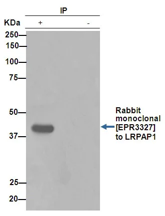 Immunoprecipitation - Anti-LRPAP1 antibody [EPR3327] (AB76500)