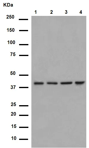 Western blot - Anti-LRPAP1 antibody [EPR3327] (AB76500)