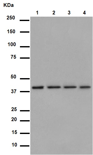 Western blot - Anti-LRPAP1 antibody [EPR3327] (AB76500), expandable thumbnail