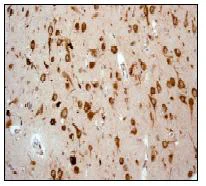 Immunohistochemistry (Formalin/PFA-fixed paraffin-embedded sections) - Anti-LRPAP1 antibody [EPR3327] - BSA and Azide free (AB247482)
