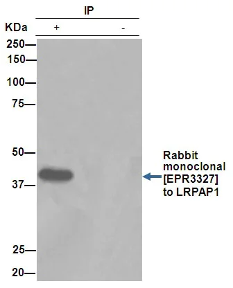 Immunoprecipitation - Anti-LRPAP1 antibody [EPR3327] - BSA and Azide free (AB247482)