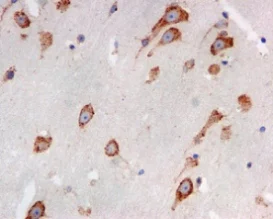 Immunohistochemistry (Formalin/PFA-fixed paraffin-embedded sections) - Anti-LRPAP1 antibody [EPR3328] (AB133488)