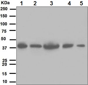 Western blot - Anti-LRPAP1 antibody [EPR3328] - BSA and Azide free (AB248519), expandable thumbnail