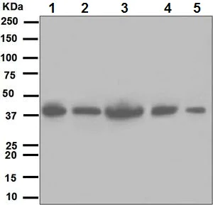 Western blot - Anti-LRPAP1 antibody [EPR3328] - BSA and Azide free (AB248519)