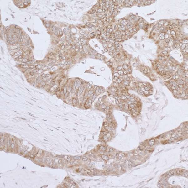 Immunohistochemistry (Formalin/PFA-fixed paraffin-embedded sections) - Anti-LRPPRC/GP130 antibody (AB205022), expandable thumbnail